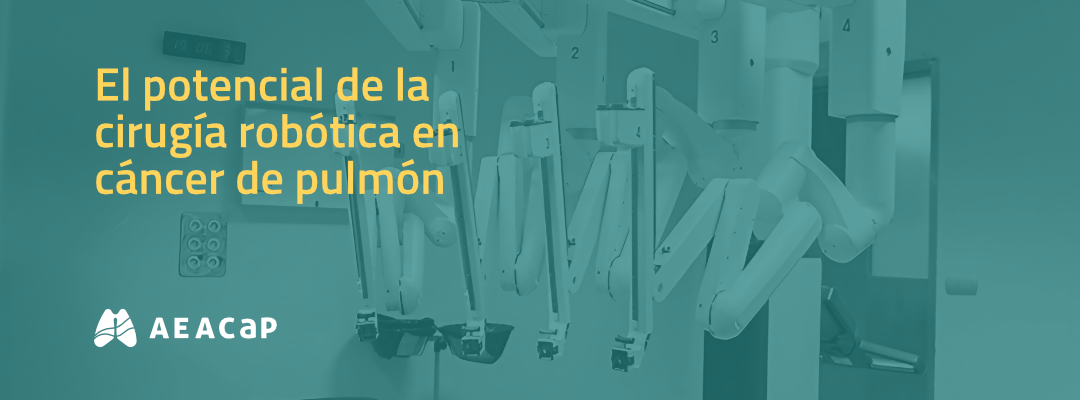 Seminario web 'El potencial de la cirugía robótica en cáncer de pulmón'
