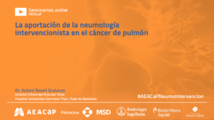 Seminario web ‘La aportación de la neumología intervencionista en el cáncer de pulmón’